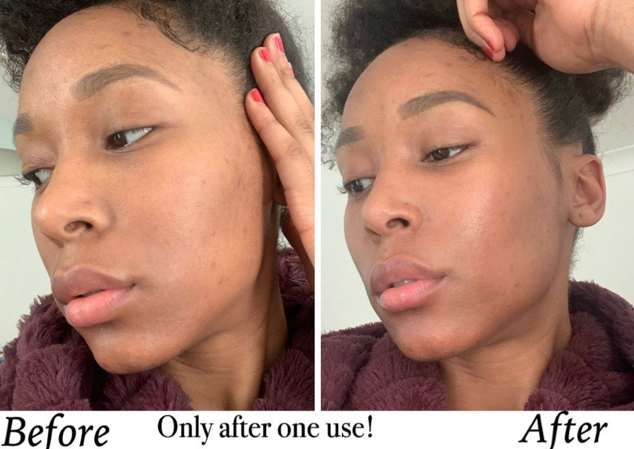 Face Steam Herbs